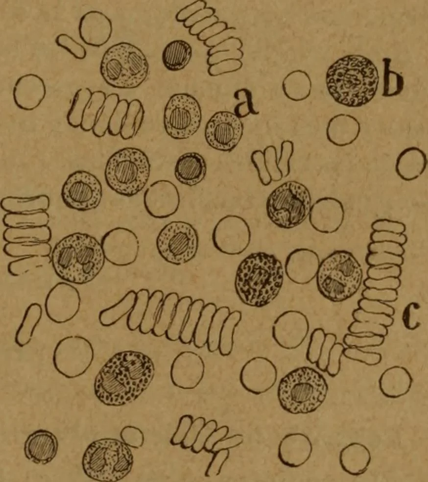 An illustration from Manual de anatomía patológica general : seguida de un resumen de microscopia aplicada a la histología y bacteriología patológicas, 1896, leaf 348
