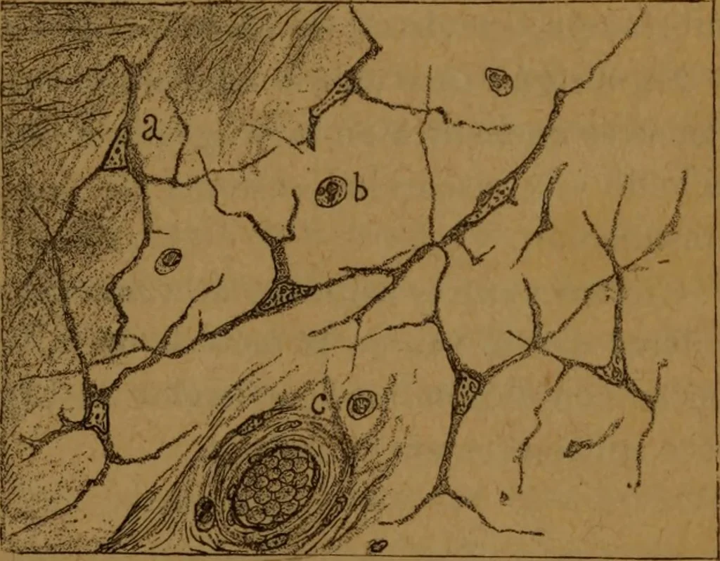 An illustration from Manual de anatomía patológica general : seguida de un resumen de microscopia aplicada a la histología y bacteriología patológicas, 1896, leaf 36
