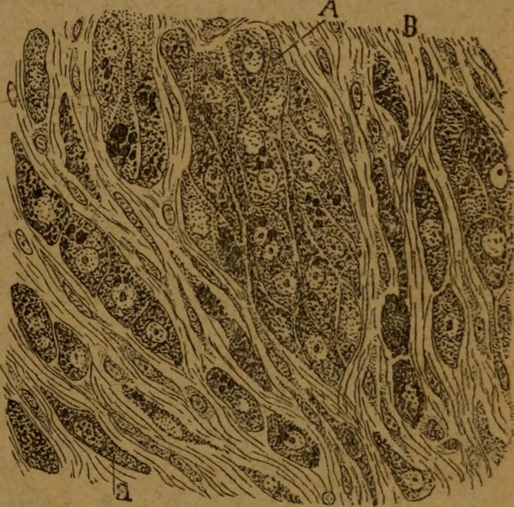 An illustration from Manual de anatomía patológica general : seguida de un resumen de microscopia aplicada a la histología y bacteriología patológicas, 1896, leaf 46