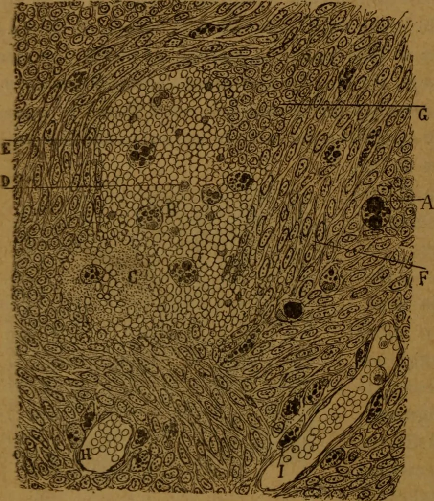 An illustration from Manual de anatomía patológica general : seguida de un resumen de microscopia aplicada a la histología y bacteriología patológicas, 1896, leaf 47
