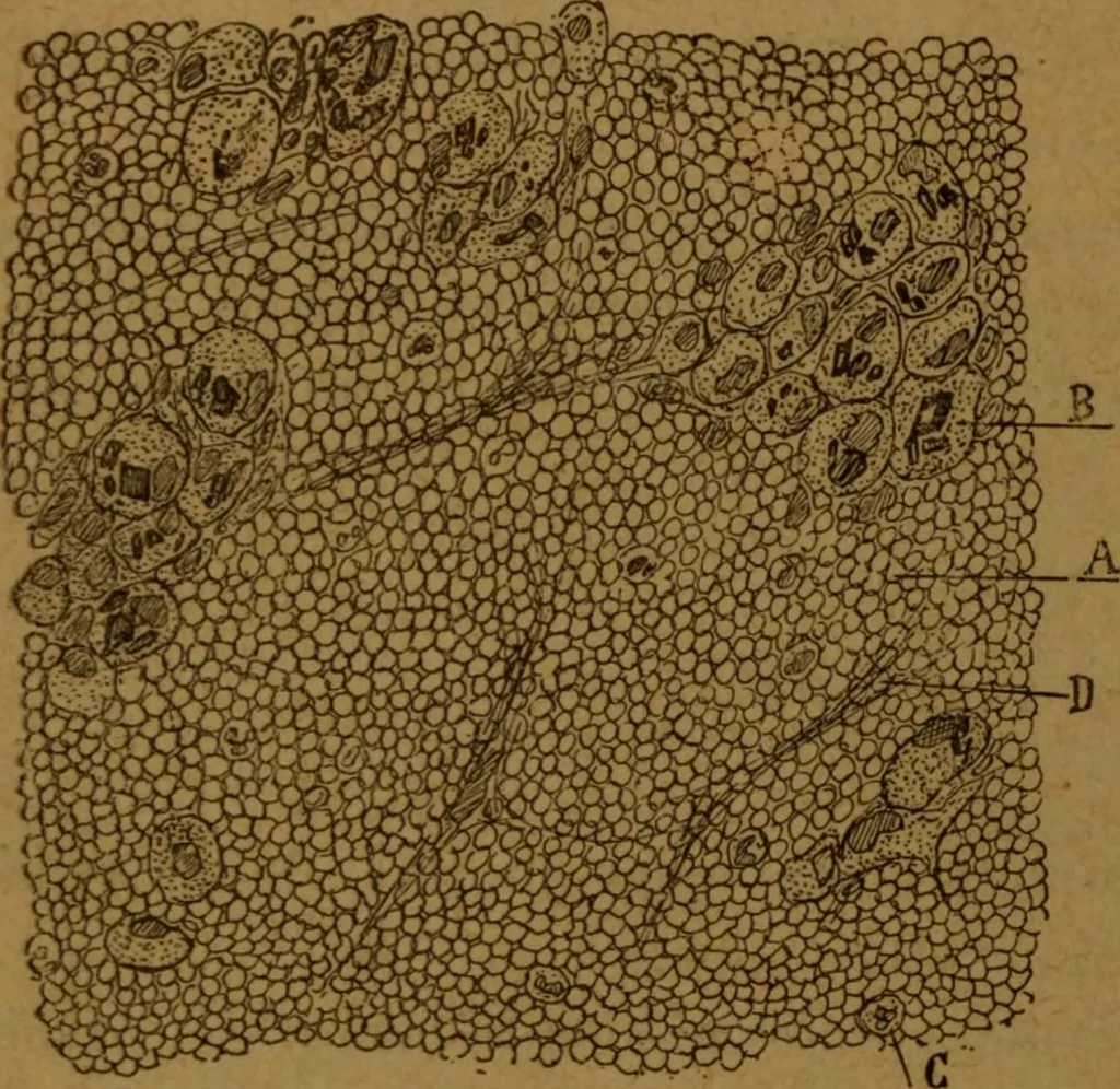 An illustration from Manual de anatomía patológica general : seguida de un resumen de microscopia aplicada a la histología y bacteriología patológicas, 1896, leaf 49