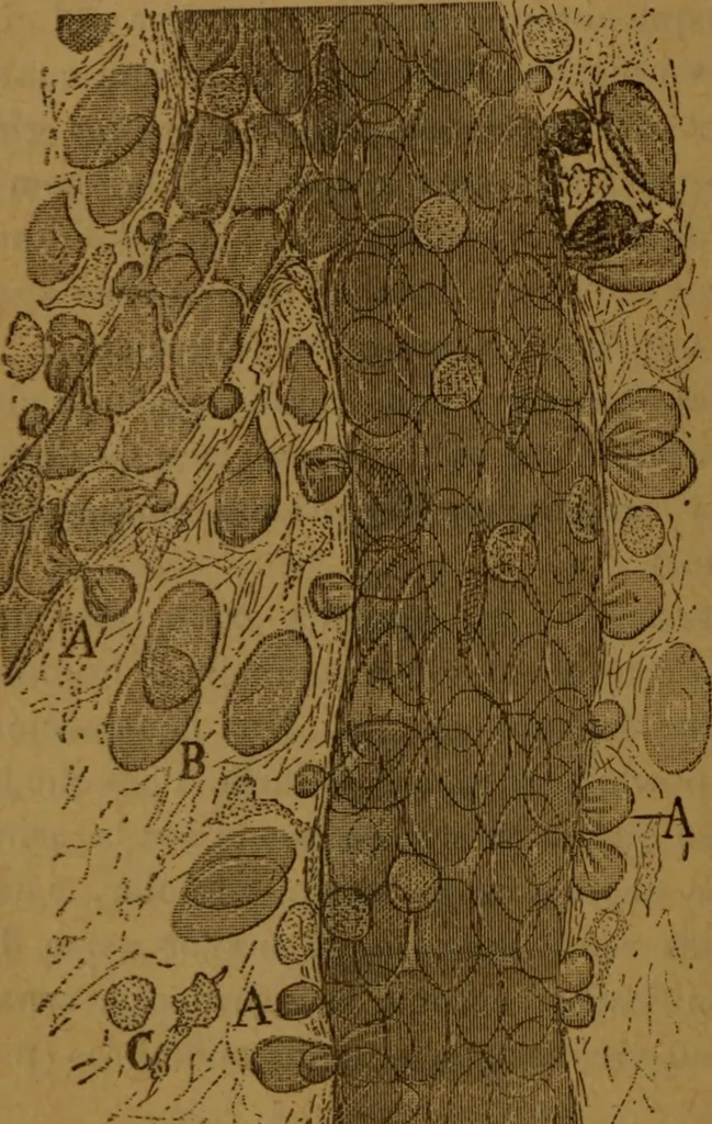 An illustration from Manual de anatomía patológica general : seguida de un resumen de microscopia aplicada a la histología y bacteriología patológicas, 1896, leaf 65