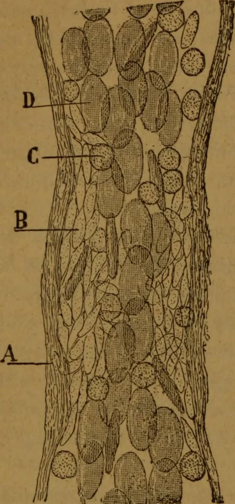 An illustration from Manual de anatomía patológica general : seguida de un resumen de microscopia aplicada a la histología y bacteriología patológicas, 1896, leaf 71