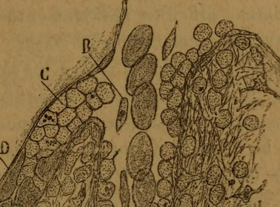 An illustration from Manual de anatomía patológica general : seguida de un resumen de microscopia aplicada a la histología y bacteriología patológicas, 1896, leaf 80