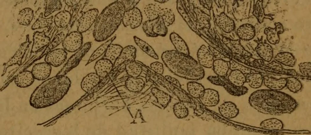 An illustration from Manual de anatomía patológica general : seguida de un resumen de microscopia aplicada a la histología y bacteriología patológicas, 1896, leaf 80