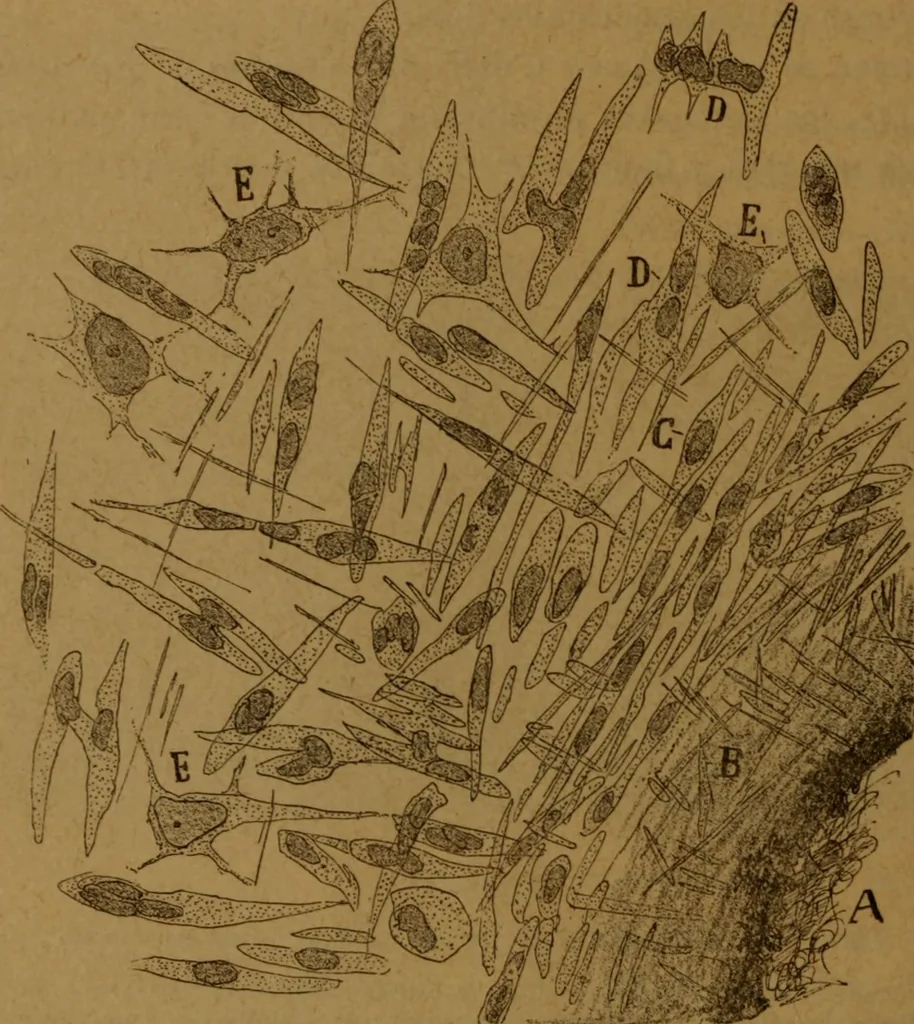 An illustration from Manual de anatomía patológica general : seguida de un resumen de microscopia aplicada a la histología y bacteriología patológicas, 1896, leaf 87