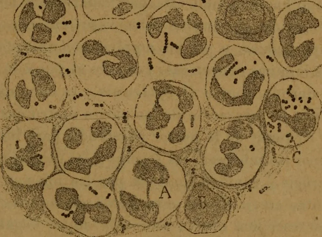 An illustration from Manual de anatomía patológica general : seguida de un resumen de microscopia aplicada a la histología y bacteriología patológicas, 1896, leaf 90