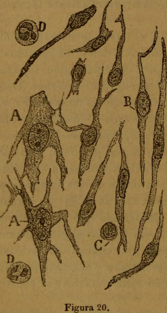 An illustration from Manual de anatomía patológica general : seguida de un resumen de microscopia aplicada a la histología y bacteriología patológicas, 1896, leaf 95