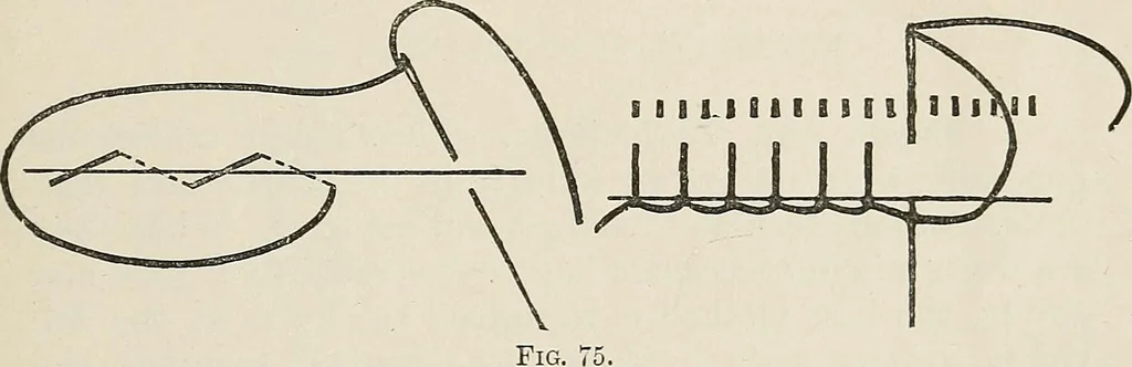 An illustration from A manual of needlework, knitting and cutting out for evening continuation schools, 1894, leaf 146