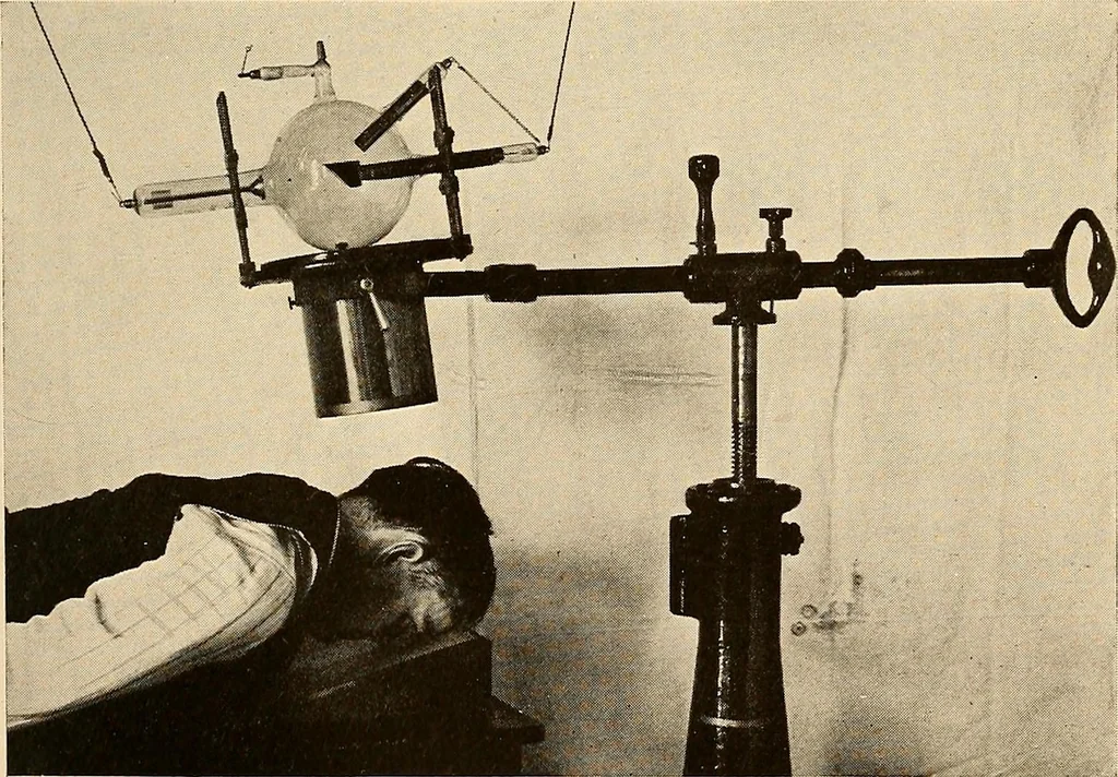 An illustration from A manual of X-ray technic, 1917, leaf 102
