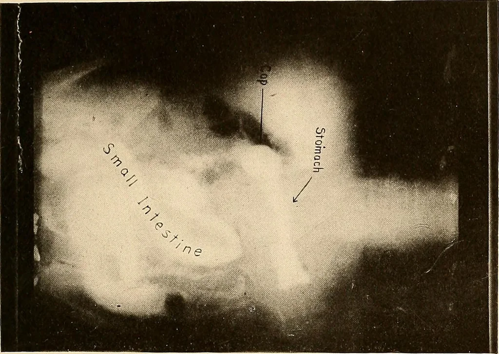 An illustration from A manual of X-ray technic, 1917, leaf 134