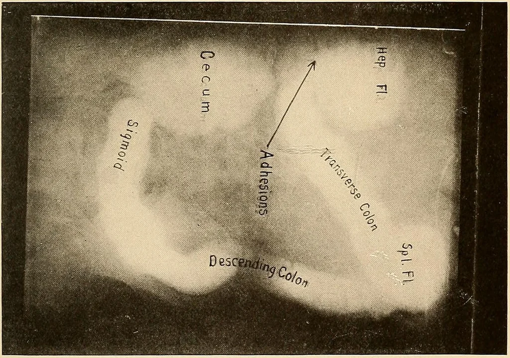 An illustration from A manual of X-ray technic, 1917, leaf 142