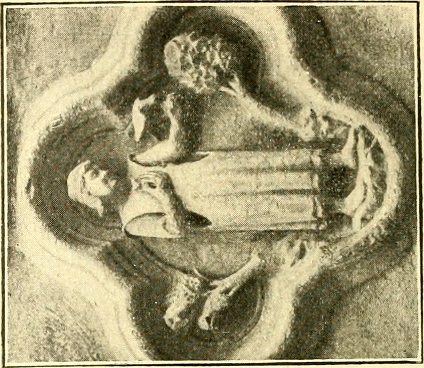 An illustration from Manuel d'archeologie francaise depuis les temps mérovingiens jusqu'à la renaissance .., 1902, leaf 79