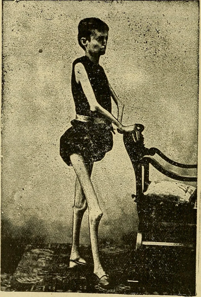 An illustration from Manuel de radioscopie et de radiographie par l'emploi des rayons X, 1900, leaf 23