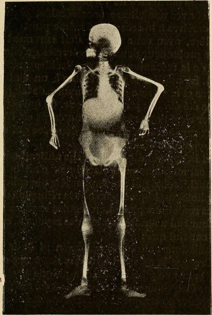 An illustration from Manuel de radioscopie et de radiographie par l'emploi des rayons X, 1900, leaf 24