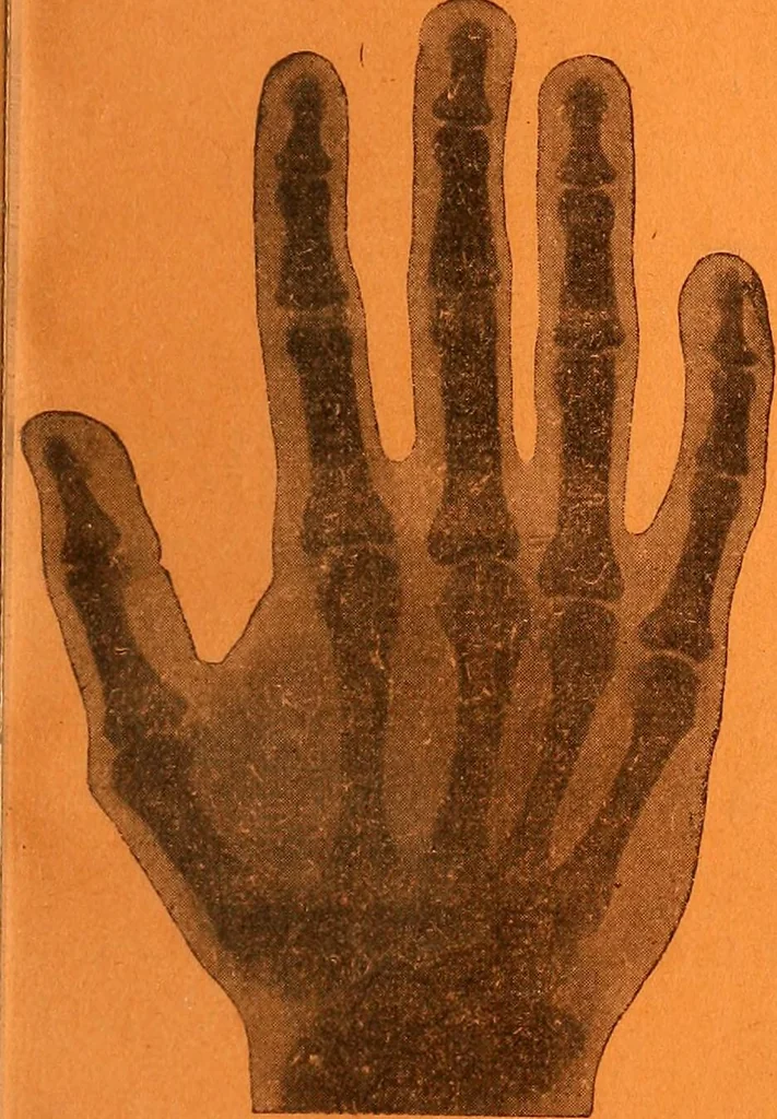 An illustration from Manuel de radioscopie et de radiographie par l'emploi des rayons X, 1900, leaf 4
