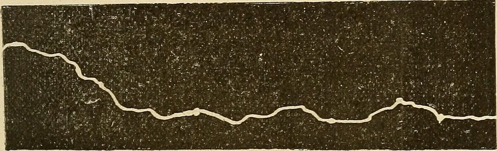An illustration from Manuel de radioscopie et de radiographie par l'emploi des rayons X, 1900, leaf 42