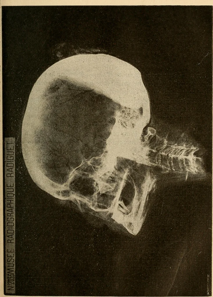 An illustration from Manuel de radioscopie et de radiographie par l'emploi des rayons X, 1900, leaf 44