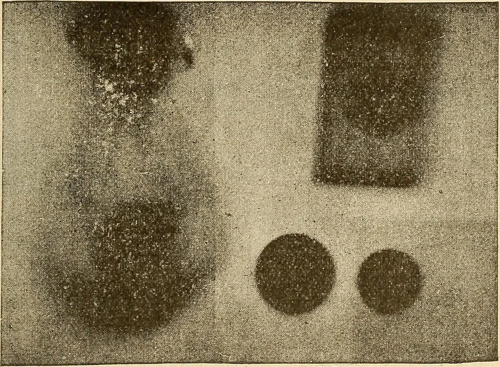An illustration from Manuel de radioscopie et de radiographie par l'emploi des rayons X, 1900, leaf 66