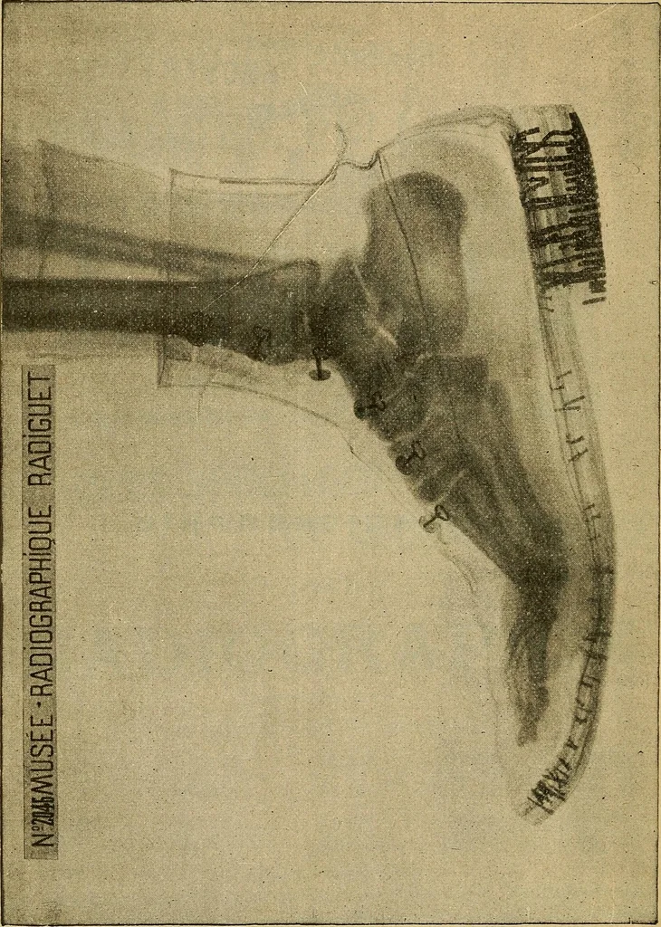An illustration from Manuel de radioscopie et de radiographie par l'emploi des rayons X, 1900, leaf 7