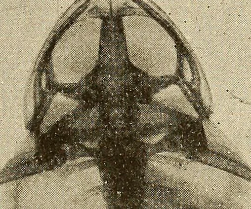 An illustration from Manuel de radioscopie et de radiographie par l'emploi des rayons X, 1900, leaf 88