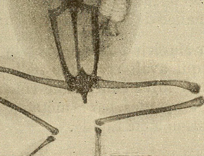 An illustration from Manuel de radioscopie et de radiographie par l'emploi des rayons X, 1900, leaf 88