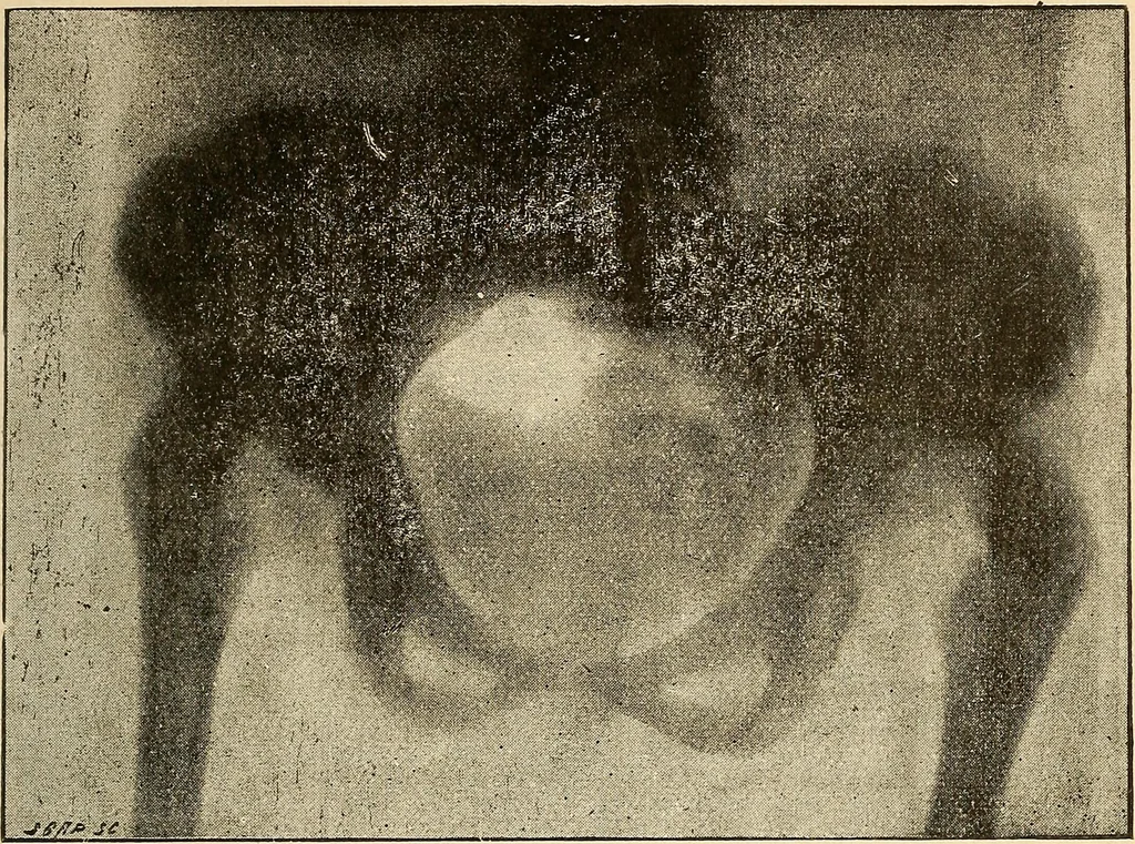An illustration from Manuel de radioscopie et de radiographie par l'emploi des rayons X, 1900, leaf 90