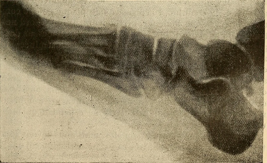 An illustration from Manuel de radioscopie et de radiographie par l'emploi des rayons X, 1900, leaf 90