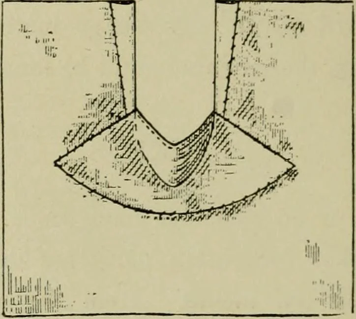 An illustration from Margaret J. Blair's system of sewing and garment drafting, 1904, leaf 55