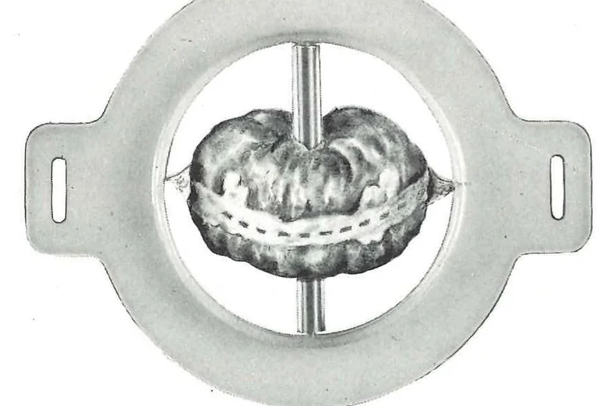 An illustration from Marsan Ostomy Appliances 1969, 1969, leaf 1