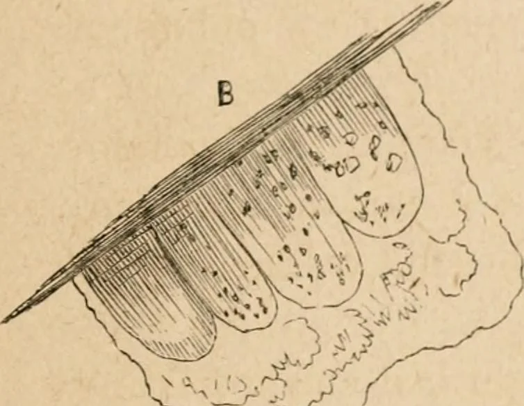 An illustration from Marvels of pond-life; or, A year's microscopic recreations among the polyps, infusoria, rotifers, water-bears and polyzoa, 1871, leaf 138