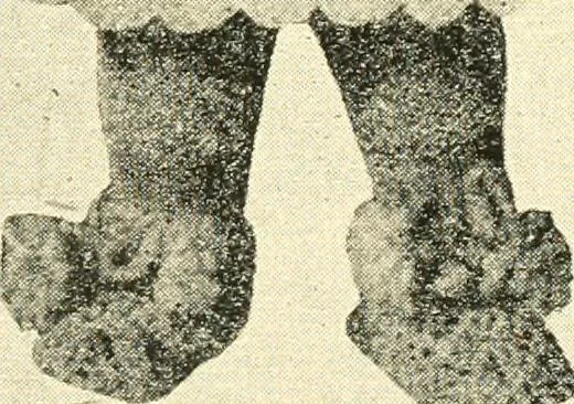 An illustration from The Mary Frances knitting and crocheting book;, 1918, leaf 102