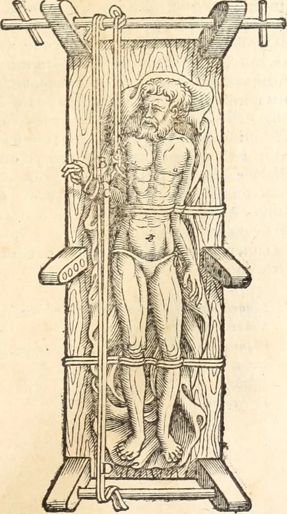 An illustration from Medicae artis principes, post Hippocratem & Galenum. Graeci Latinitate donati, Aretaeus, Ruffus Ephesius, Oribasius, Paulus Aegineta, Aëtius, Alex. Trallianus, Actuarius, Nic. Myrepsus. Latini, Corn. Celsus, Scrib. Largus, Marcell. Empiricus. Aliíque praeterea, quorum unius nomen ignoratur. Index non solùm copiosus, sed etiam ordine artificioso omnia digesta habens. Hippocr. aliquot loci cum Corn. Celsi interpretatione, 1567, leaf 100
