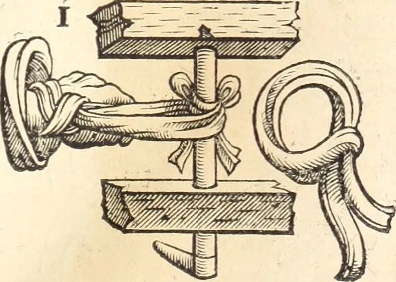 An illustration from Medicae artis principes, post Hippocratem & Galenum. Graeci Latinitate donati, Aretaeus, Ruffus Ephesius, Oribasius, Paulus Aegineta, Aëtius, Alex. Trallianus, Actuarius, Nic. Myrepsus. Latini, Corn. Celsus, Scrib. Largus, Marcell. Empiricus. Aliíque praeterea, quorum unius nomen ignoratur. Index non solùm copiosus, sed etiam ordine artificioso omnia digesta habens. Hippocr. aliquot loci cum Corn. Celsi interpretatione, 1567, leaf 84