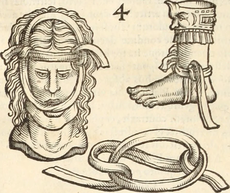An illustration from Medicae artis principes, post Hippocratem & Galenum. Graeci Latinitate donati, Aretaeus, Ruffus Ephesius, Oribasius, Paulus Aegineta, Aëtius, Alex. Trallianus, Actuarius, Nic. Myrepsus. Latini, Corn. Celsus, Scrib. Largus, Marcell. Empiricus. Aliíque praeterea, quorum unius nomen ignoratur. Index non solùm copiosus, sed etiam ordine artificioso omnia digesta habens. Hippocr. aliquot loci cum Corn. Celsi interpretatione, 1567, leaf 85