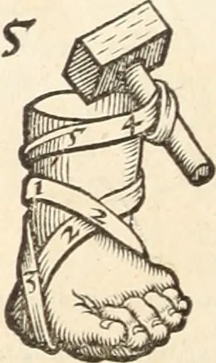 An illustration from Medicae artis principes, post Hippocratem & Galenum. Graeci Latinitate donati, Aretaeus, Ruffus Ephesius, Oribasius, Paulus Aegineta, Aëtius, Alex. Trallianus, Actuarius, Nic. Myrepsus. Latini, Corn. Celsus, Scrib. Largus, Marcell. Empiricus. Aliíque praeterea, quorum unius nomen ignoratur. Index non solùm copiosus, sed etiam ordine artificioso omnia digesta habens. Hippocr. aliquot loci cum Corn. Celsi interpretatione, 1567, leaf 85