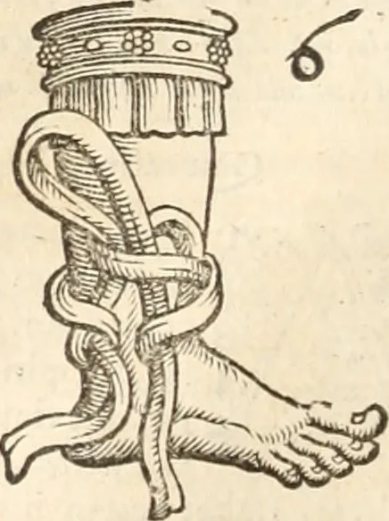 An illustration from Medicae artis principes, post Hippocratem & Galenum. Graeci Latinitate donati, Aretaeus, Ruffus Ephesius, Oribasius, Paulus Aegineta, Aëtius, Alex. Trallianus, Actuarius, Nic. Myrepsus. Latini, Corn. Celsus, Scrib. Largus, Marcell. Empiricus. Aliíque praeterea, quorum unius nomen ignoratur. Index non solùm copiosus, sed etiam ordine artificioso omnia digesta habens. Hippocr. aliquot loci cum Corn. Celsi interpretatione, 1567, leaf 85