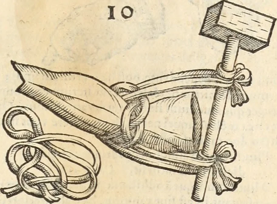 An illustration from Medicae artis principes, post Hippocratem & Galenum. Graeci Latinitate donati, Aretaeus, Ruffus Ephesius, Oribasius, Paulus Aegineta, Aëtius, Alex. Trallianus, Actuarius, Nic. Myrepsus. Latini, Corn. Celsus, Scrib. Largus, Marcell. Empiricus. Aliíque praeterea, quorum unius nomen ignoratur. Index non solùm copiosus, sed etiam ordine artificioso omnia digesta habens. Hippocr. aliquot loci cum Corn. Celsi interpretatione, 1567, leaf 86