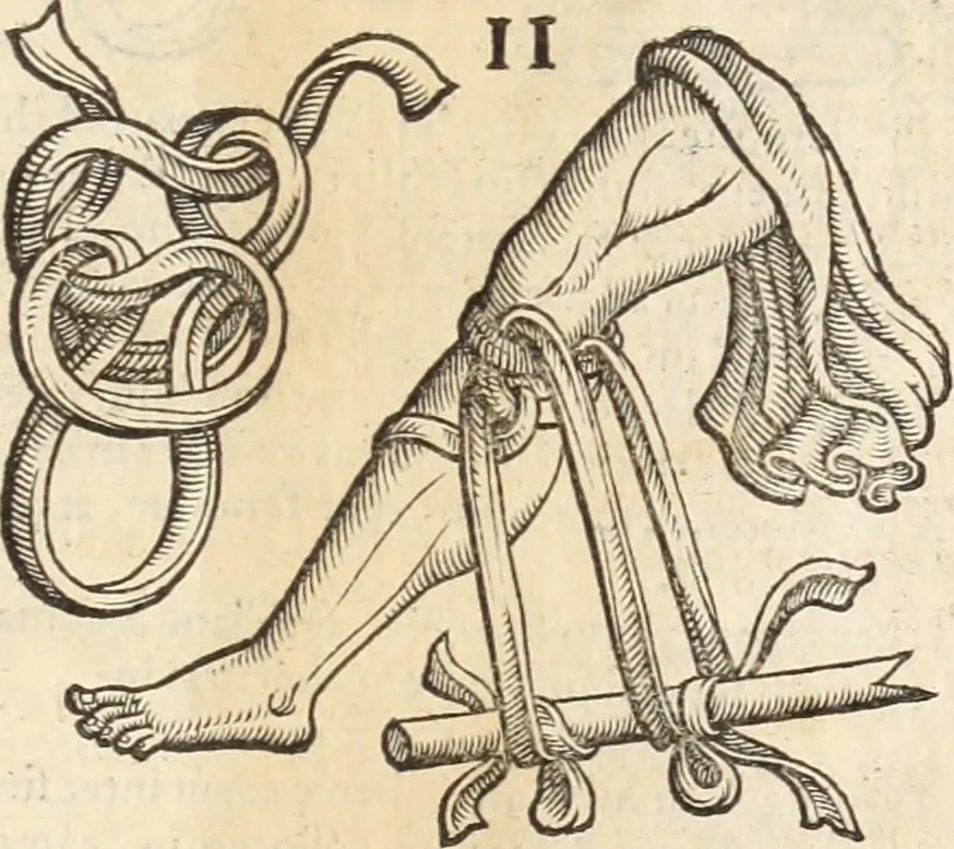 An illustration from Medicae artis principes, post Hippocratem & Galenum. Graeci Latinitate donati, Aretaeus, Ruffus Ephesius, Oribasius, Paulus Aegineta, Aëtius, Alex. Trallianus, Actuarius, Nic. Myrepsus. Latini, Corn. Celsus, Scrib. Largus, Marcell. Empiricus. Aliíque praeterea, quorum unius nomen ignoratur. Index non solùm copiosus, sed etiam ordine artificioso omnia digesta habens. Hippocr. aliquot loci cum Corn. Celsi interpretatione, 1567, leaf 86
