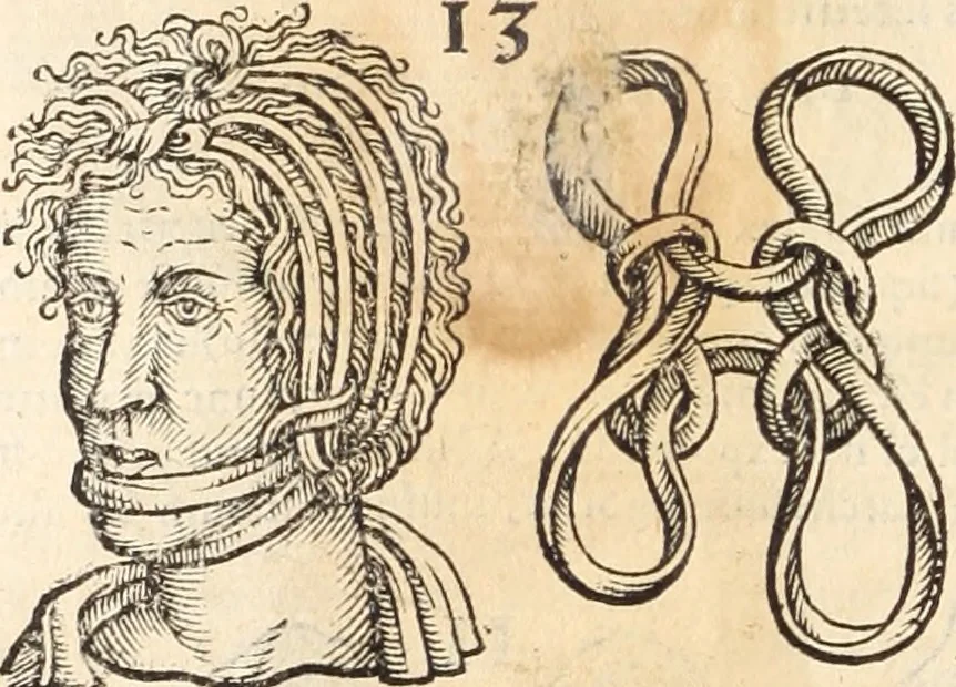 An illustration from Medicae artis principes, post Hippocratem & Galenum. Graeci Latinitate donati, Aretaeus, Ruffus Ephesius, Oribasius, Paulus Aegineta, Aëtius, Alex. Trallianus, Actuarius, Nic. Myrepsus. Latini, Corn. Celsus, Scrib. Largus, Marcell. Empiricus. Aliíque praeterea, quorum unius nomen ignoratur. Index non solùm copiosus, sed etiam ordine artificioso omnia digesta habens. Hippocr. aliquot loci cum Corn. Celsi interpretatione, 1567, leaf 87