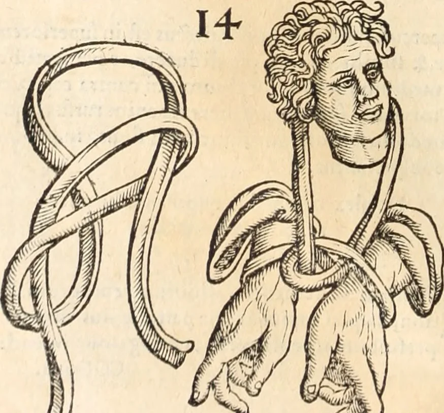 An illustration from Medicae artis principes, post Hippocratem & Galenum. Graeci Latinitate donati, Aretaeus, Ruffus Ephesius, Oribasius, Paulus Aegineta, Aëtius, Alex. Trallianus, Actuarius, Nic. Myrepsus. Latini, Corn. Celsus, Scrib. Largus, Marcell. Empiricus. Aliíque praeterea, quorum unius nomen ignoratur. Index non solùm copiosus, sed etiam ordine artificioso omnia digesta habens. Hippocr. aliquot loci cum Corn. Celsi interpretatione, 1567, leaf 87