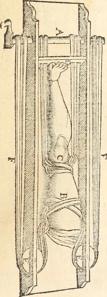 An illustration from Medicae artis principes, post Hippocratem & Galenum. Graeci Latinitate donati, Aretaeus, Ruffus Ephesius, Oribasius, Paulus Aegineta, Aëtius, Alex. Trallianus, Actuarius, Nic. Myrepsus. Latini, Corn. Celsus, Scrib. Largus, Marcell. Empiricus. Aliíque praeterea, quorum unius nomen ignoratur. Index non solùm copiosus, sed etiam ordine artificioso omnia digesta habens. Hippocr. aliquot loci cum Corn. Celsi interpretatione, 1567, leaf 90