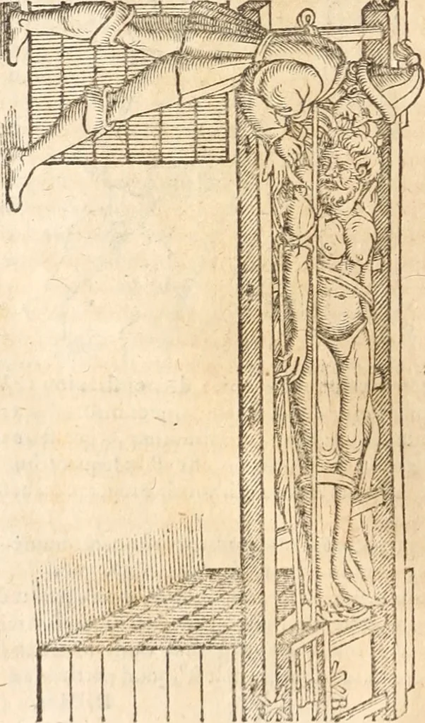 An illustration from Medicae artis principes, post Hippocratem & Galenum. Graeci Latinitate donati, Aretaeus, Ruffus Ephesius, Oribasius, Paulus Aegineta, Aëtius, Alex. Trallianus, Actuarius, Nic. Myrepsus. Latini, Corn. Celsus, Scrib. Largus, Marcell. Empiricus. Aliíque praeterea, quorum unius nomen ignoratur. Index non solùm copiosus, sed etiam ordine artificioso omnia digesta habens. Hippocr. aliquot loci cum Corn. Celsi interpretatione, 1567, leaf 93