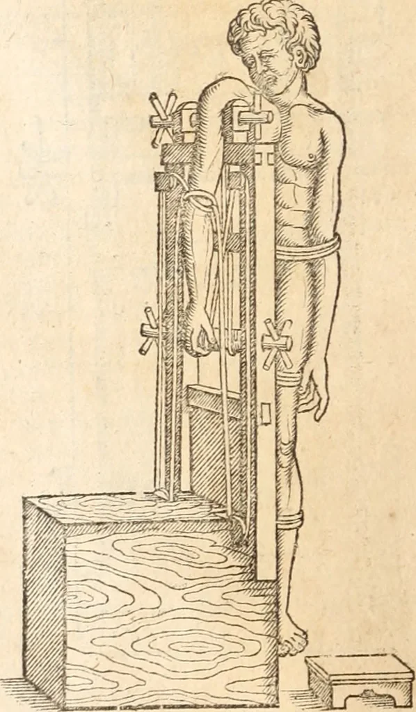 An illustration from Medicae artis principes, post Hippocratem & Galenum. Graeci Latinitate donati, Aretaeus, Ruffus Ephesius, Oribasius, Paulus Aegineta, Aëtius, Alex. Trallianus, Actuarius, Nic. Myrepsus. Latini, Corn. Celsus, Scrib. Largus, Marcell. Empiricus. Aliíque praeterea, quorum unius nomen ignoratur. Index non solùm copiosus, sed etiam ordine artificioso omnia digesta habens. Hippocr. aliquot loci cum Corn. Celsi interpretatione, 1567, leaf 97