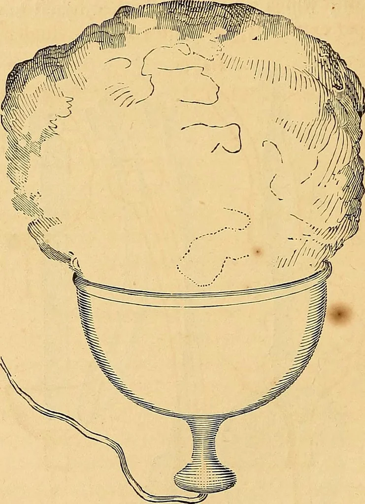 An illustration from The medical application of electricity, 1860, leaf 221