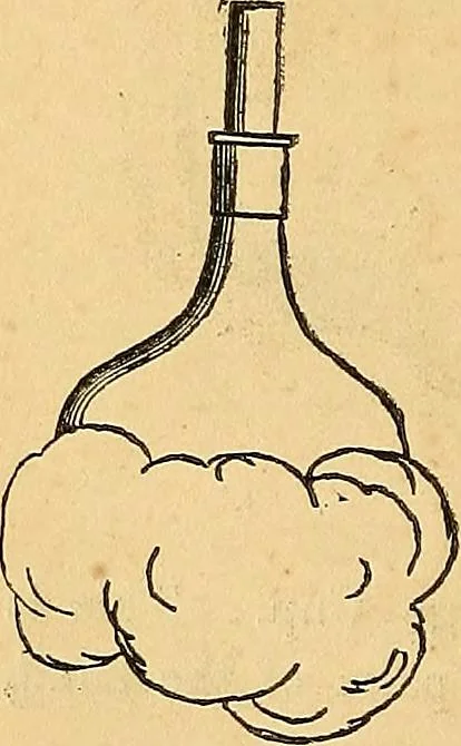 An illustration from The medical application of electricity, 1860, leaf 279