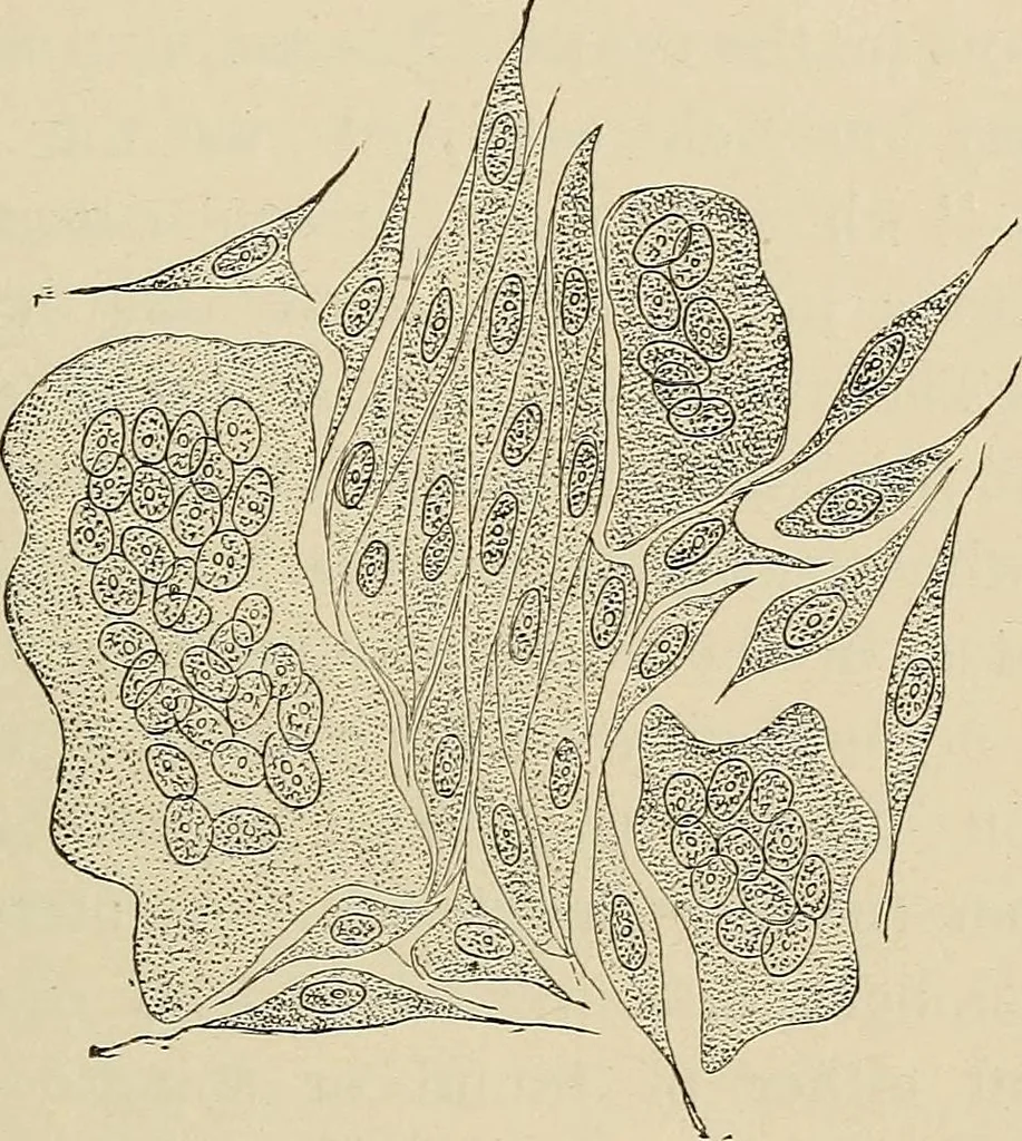 An illustration from Medical microscopy : a guide to the use of the microscope in medical practice, 1898, leaf 174