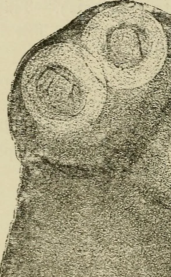 An illustration from Medical microscopy : a guide to the use of the microscope in medical practice, 1898, leaf 253