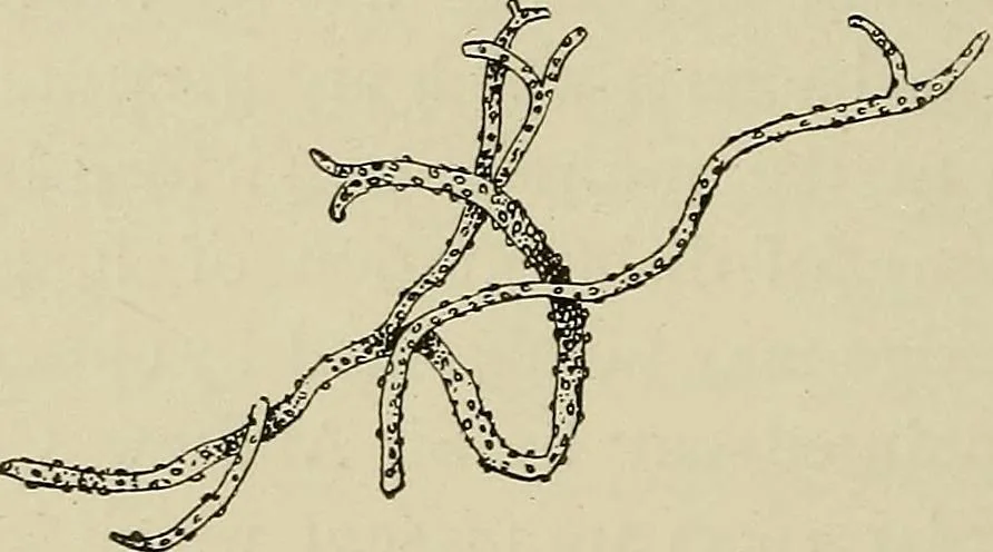 An illustration from Medical microscopy : a guide to the use of the microscope in medical practice, 1898, leaf 283