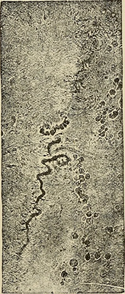 An illustration from Medical microscopy : a guide to the use of the microscope in medical practice, 1898, leaf 284